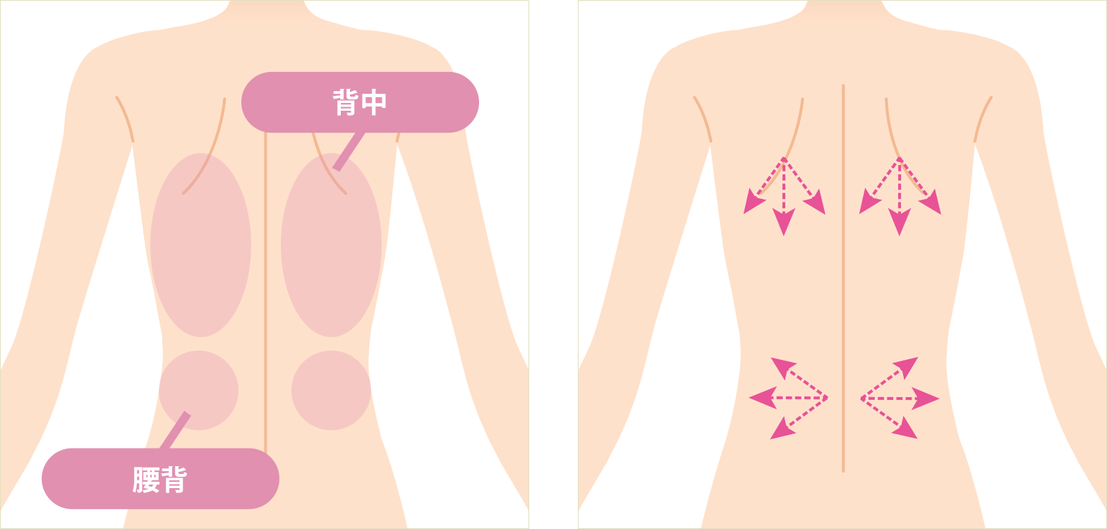 ウォータージェット 脂肪吸引 アサミ美容外科